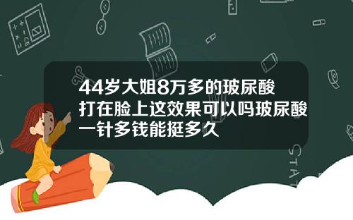 44岁大姐8万多的玻尿酸打在脸上这效果可以吗玻尿酸一针多钱能挺多久