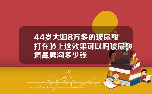 44岁大姐8万多的玻尿酸打在脸上这效果可以吗玻尿酸填鼻唇沟多少钱