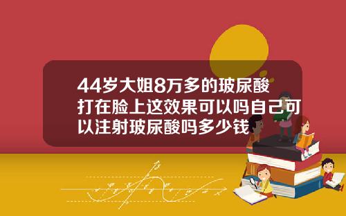 44岁大姐8万多的玻尿酸打在脸上这效果可以吗自己可以注射玻尿酸吗多少钱