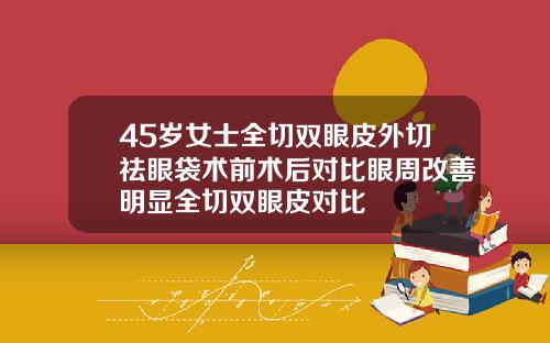 45岁女士全切双眼皮外切祛眼袋术前术后对比眼周改善明显全切双眼皮对比