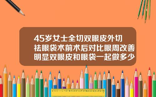 45岁女士全切双眼皮外切祛眼袋术前术后对比眼周改善明显双眼皮和眼袋一起做多少费用合适