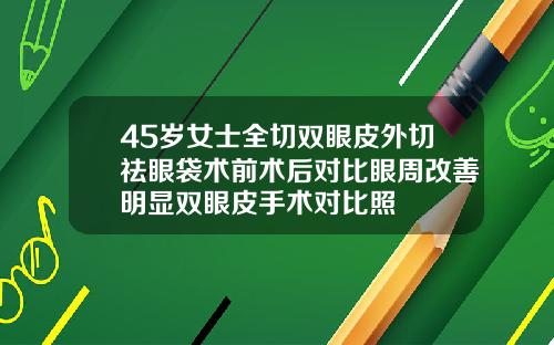 45岁女士全切双眼皮外切祛眼袋术前术后对比眼周改善明显双眼皮手术对比照