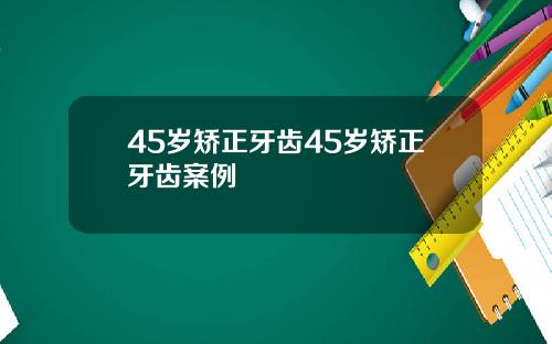 45岁矫正牙齿45岁矫正牙齿案例