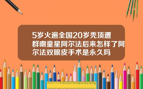 5岁火遍全国20岁秃顶遭群嘲童星阿尔法后来怎样了阿尔法双眼皮手术是永久吗
