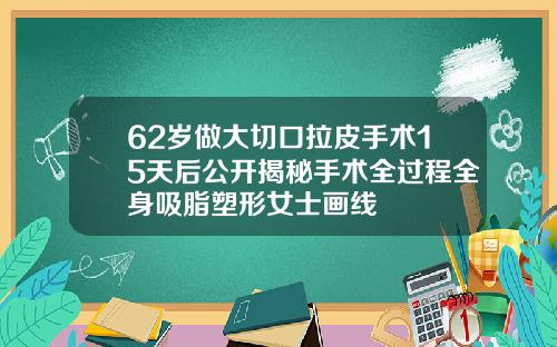 62岁做大切口拉皮手术15天后公开揭秘手术全过程全身吸脂塑形女士画线