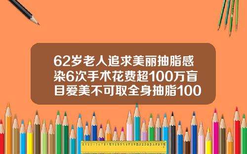 62岁老人追求美丽抽脂感染6次手术花费超100万盲目爱美不可取全身抽脂100斤的价格