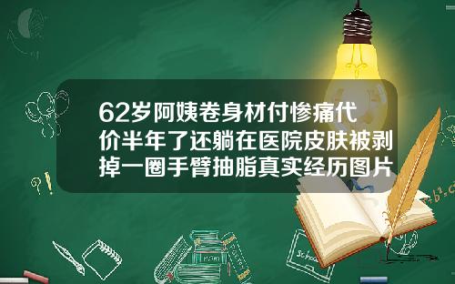 62岁阿姨卷身材付惨痛代价半年了还躺在医院皮肤被剥掉一圈手臂抽脂真实经历图片