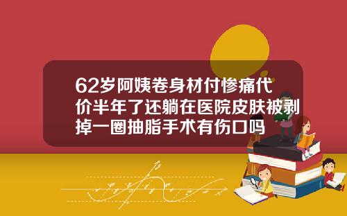 62岁阿姨卷身材付惨痛代价半年了还躺在医院皮肤被剥掉一圈抽脂手术有伤口吗