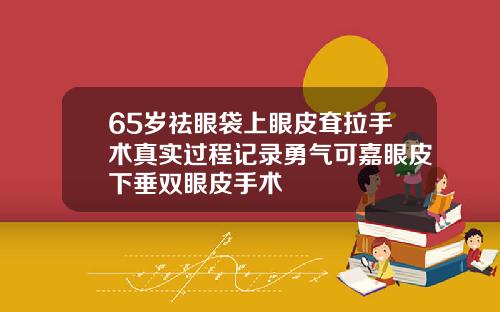 65岁祛眼袋上眼皮耷拉手术真实过程记录勇气可嘉眼皮下垂双眼皮手术