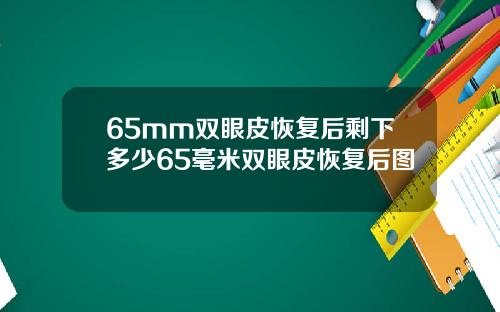 65mm双眼皮恢复后剩下多少65毫米双眼皮恢复后图