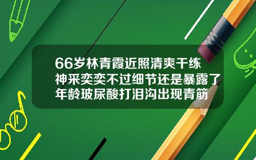 66岁林青霞近照清爽干练神采奕奕不过细节还是暴露了年龄玻尿酸打泪沟出现青筋