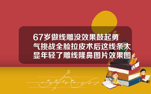 67岁做线雕没效果鼓起勇气挑战全脸拉皮术后这线条太显年轻了雕线隆鼻图片效果图