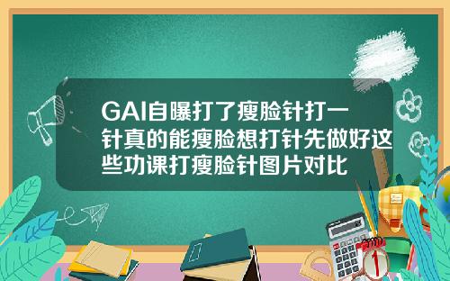 GAI自曝打了瘦脸针打一针真的能瘦脸想打针先做好这些功课打瘦脸针图片对比
