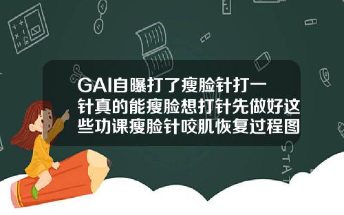 GAI自曝打了瘦脸针打一针真的能瘦脸想打针先做好这些功课瘦脸针咬肌恢复过程图