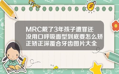 MRC戴了3年孩子遭罪还没用口呼吸面型到底要怎么矫正矫正深覆合牙齿图片大全