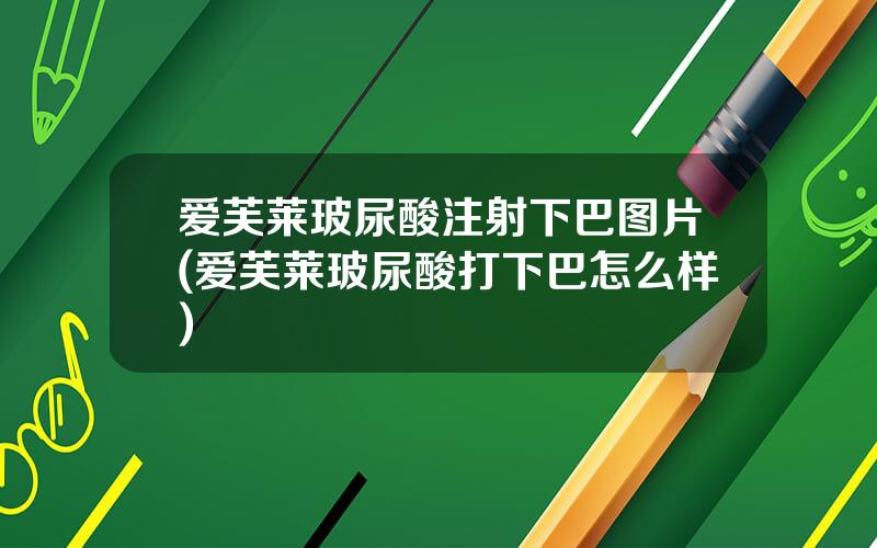 爱芙莱玻尿酸注射下巴图片(爱芙莱玻尿酸打下巴怎么样)